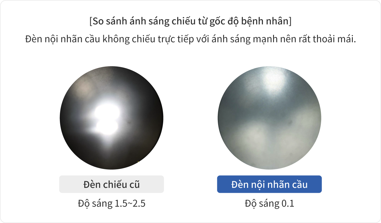 So sánh ánh sáng chiếu từ gốc độ bệnh nhân
