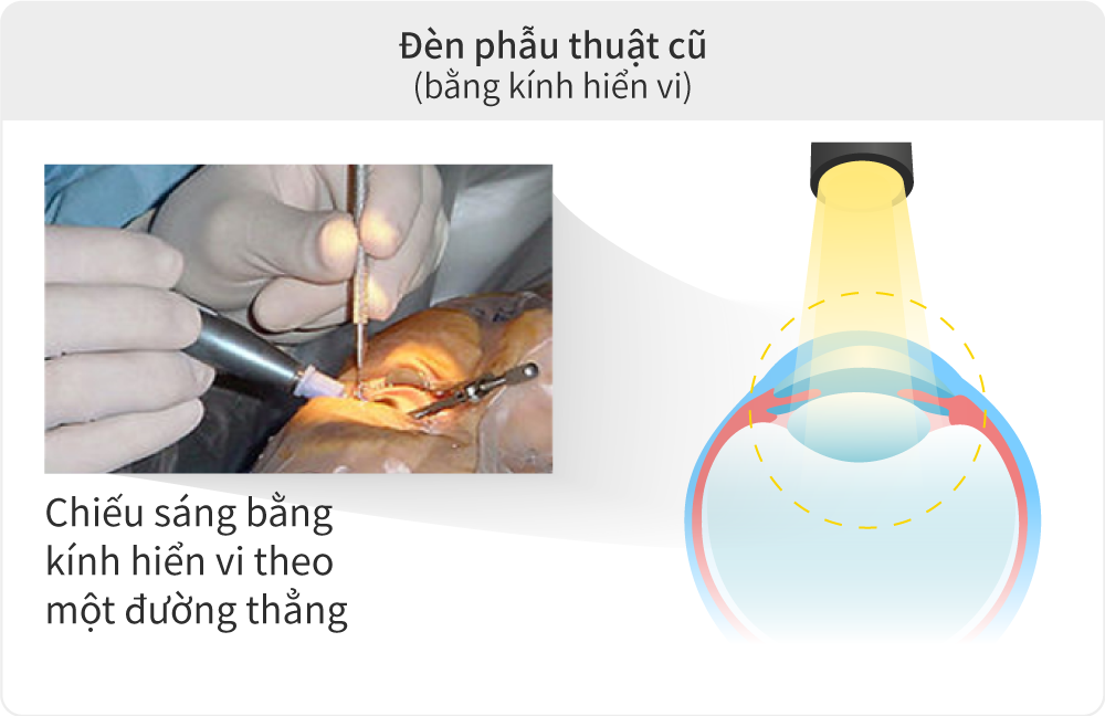Đèn phẫu thuật cũ