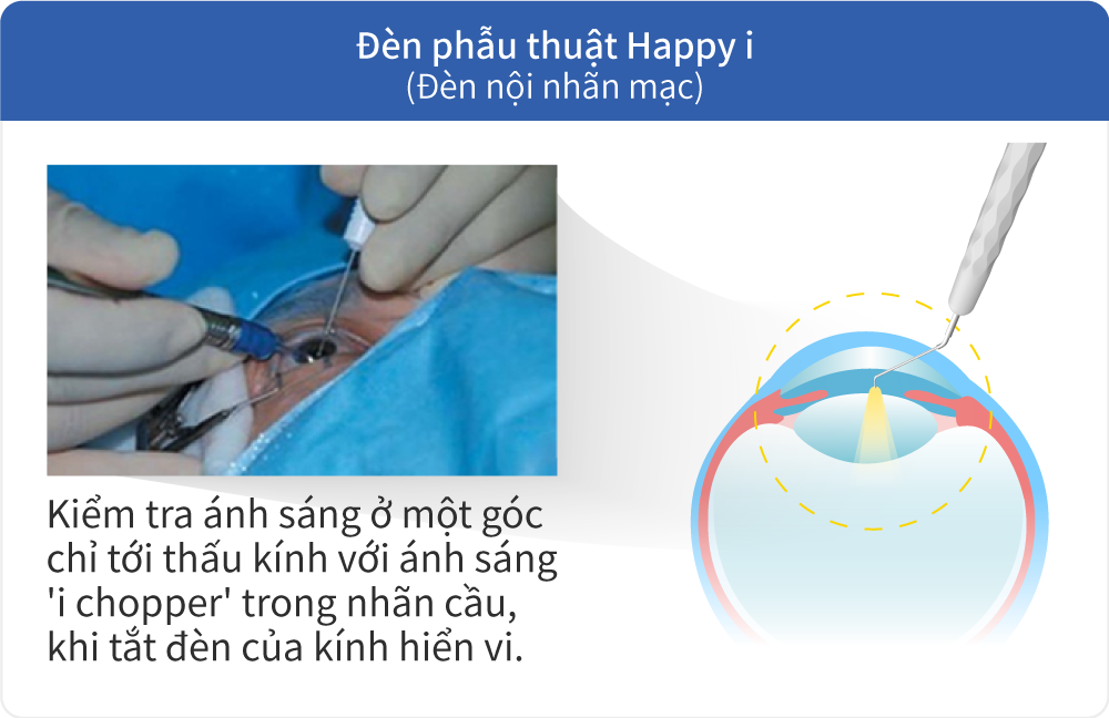 Đèn phẫu thuật Happy i